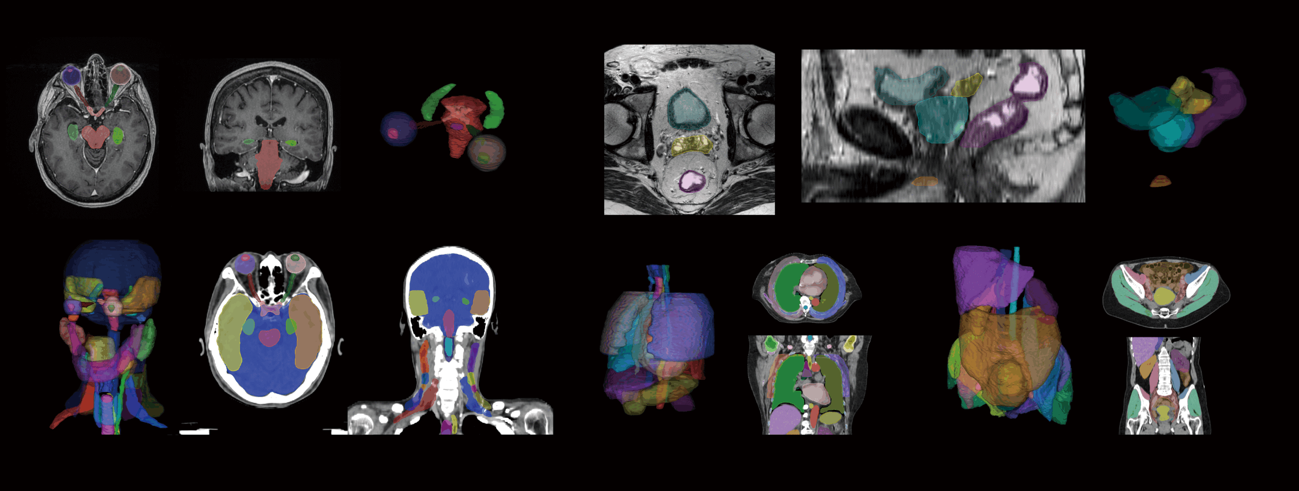 放射治療器官勾勒系統