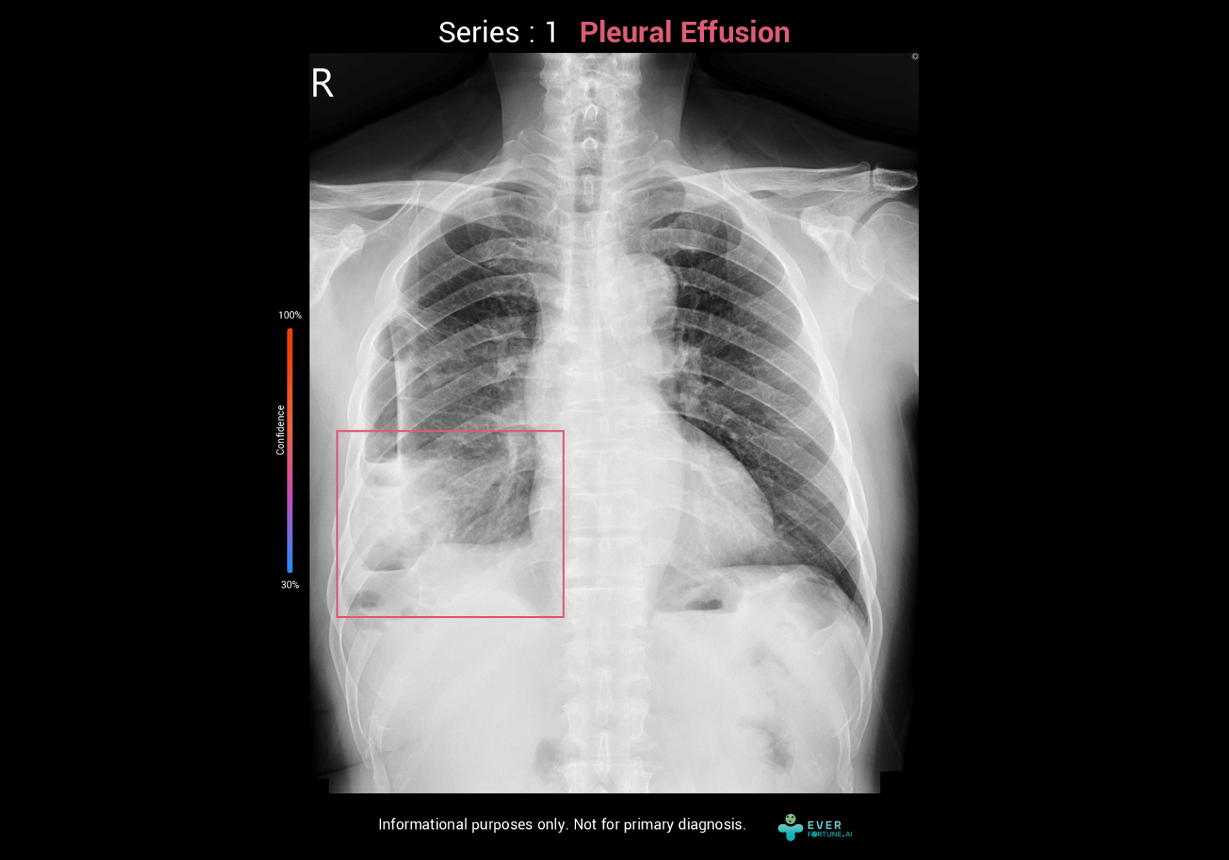 產品示意圖-更換圖檔-CXR-2-PUE
