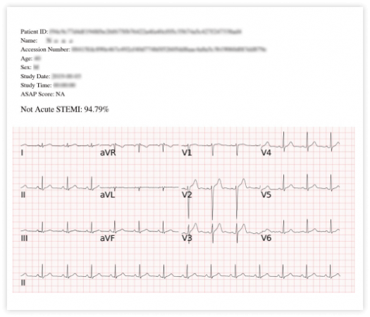 SHOWCASE_3_無STEMI 1