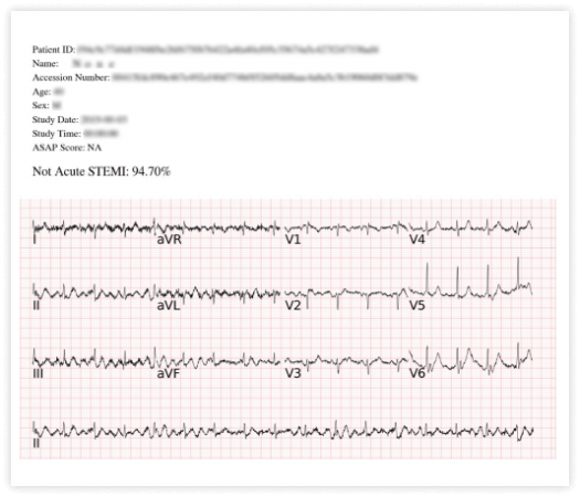 SHOWCASE_4_無STEMI 1