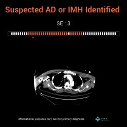 產品示意圖-新增區塊01