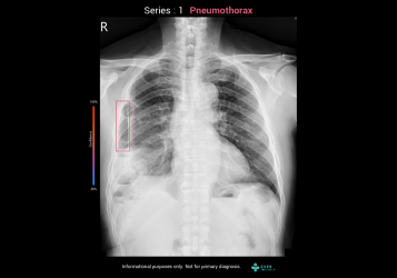 產品示意圖-更換圖檔-CXR-1-PNX